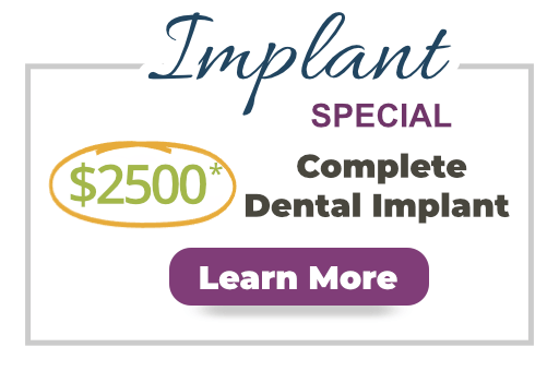 $2500 dental implant